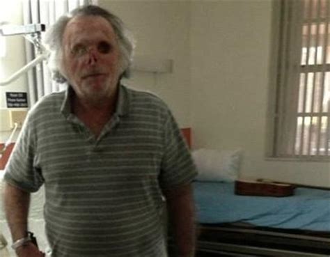 Video: One Year After Face-Eating Attack, Victim Ronald Poppo Is ...