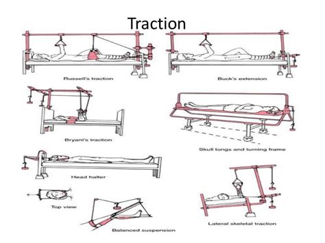 Traction