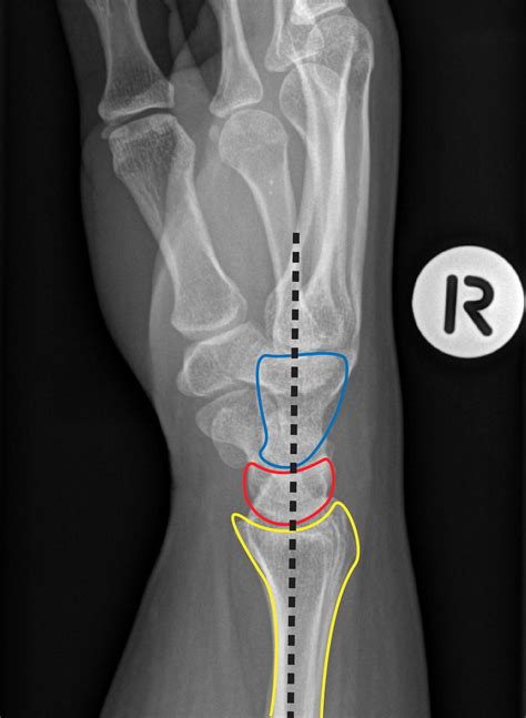 Not Your Typical Wrist Pain — EM Curious