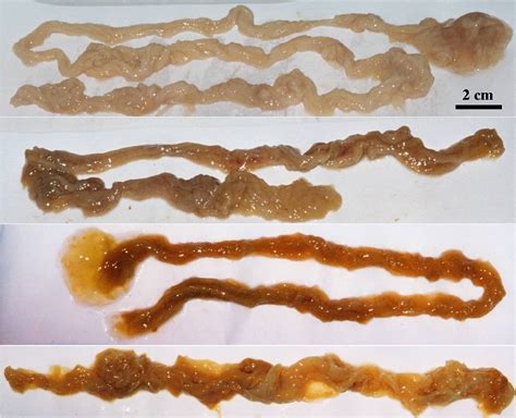 Figure 5 from Development stages of the "rope" human intestinal ...