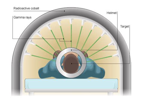 How Can Gamma Rays Treat Cancer - CancerWalls