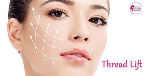 Facial Rejuvenation - Thread Lift