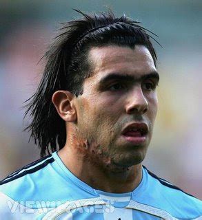 Carlos Tevez Scar