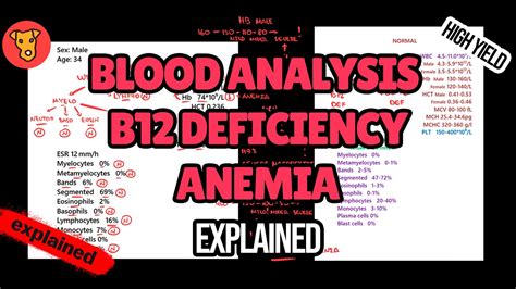 Blood analysis in B12 deficiency anemia. Pernicious anemia ...