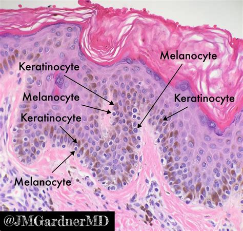 Melanocytes vs Keratinocytes Made Easy: 5-Minute Pathology Pearls | KiKo XP