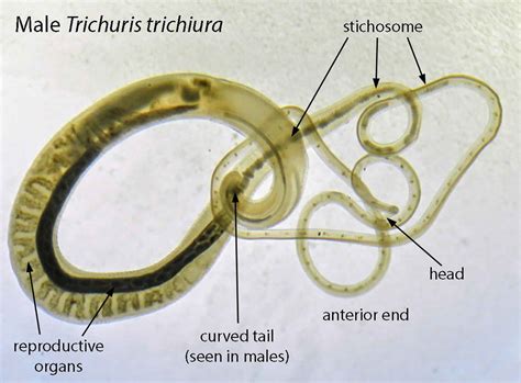 Trichuris trichiura infection, transmission, lifee cycle, symptoms ...