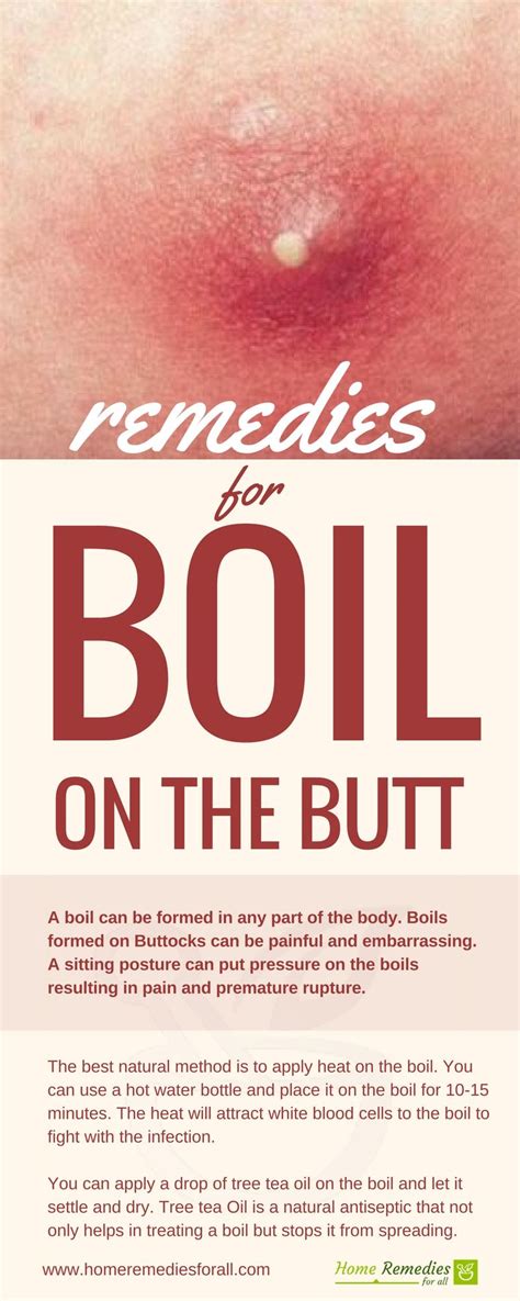 Effective Home Remedies To Get Rid Of Boil Youtube