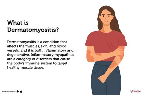 Dermatomyositis: Causes, Symptoms, Treatment and Cost