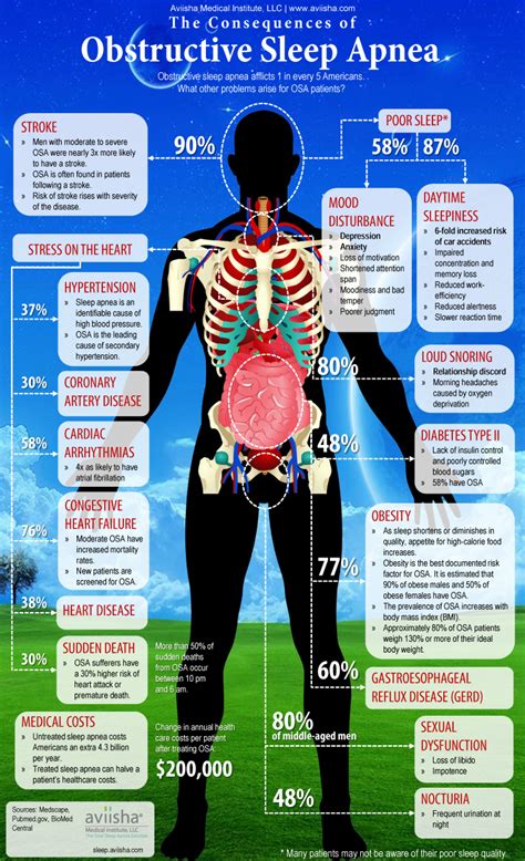 Infographic on Obstructive Sleep Apnea (OSA)