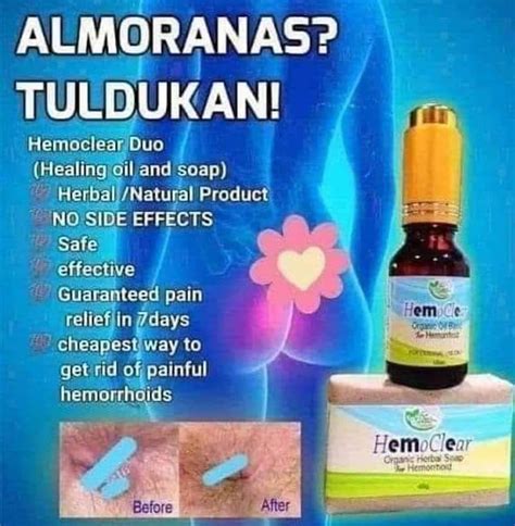 ANO ANG ALMORANAS? Ang almoranas o hemorrhoids ay namamagang mga ugat ...