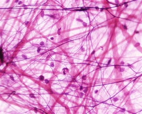 Kinds of Connective Tissue