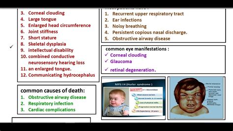 Mucopolysaccharidosis ( Simplified Metabolic Disorders ) - YouTube