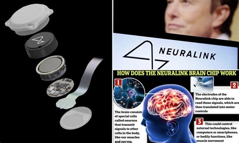 Elon Musk says first human patient implanted with a Neuralink brain ...