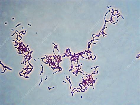 Streptococcus Pyogenes Gram Stain