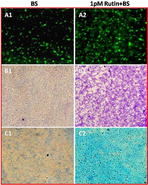 Morphology of biofilm formed examined by light microscopy. Bacterial ...