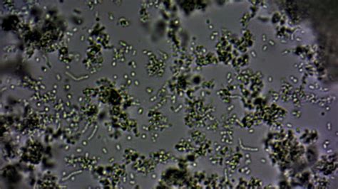 Lactobacillus bulgaricus and Streptococcus thermophilus - Biological ...