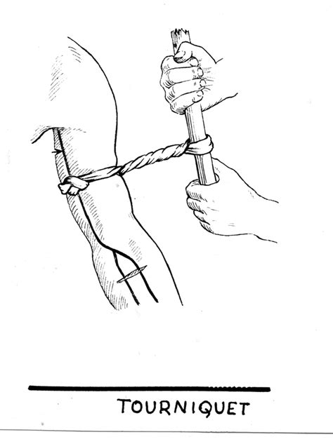 How and When to Use a Tourniquet