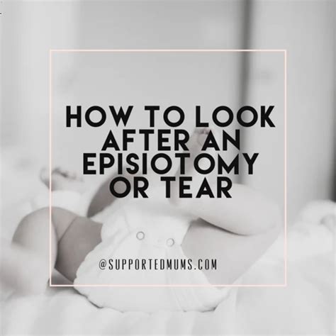 How to Massage Episiotomy Scar Tissue for Optimal Healing and Comfort