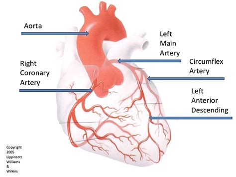 Coronary Angiography - HeartWest