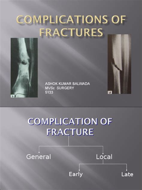 Complication of Fracture | Bone | Musculoskeletal System