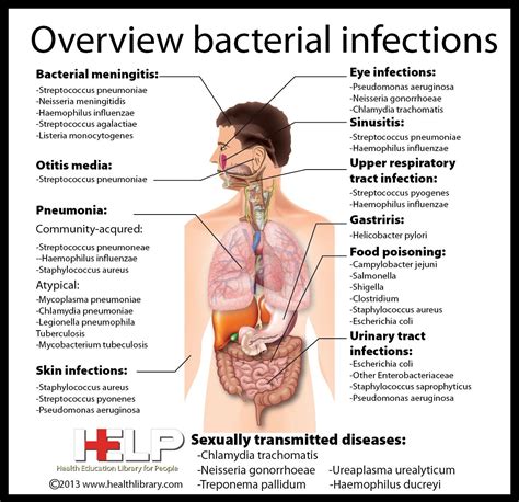 Bacterial Infections | Bacterial infection, Medical knowledge, Medical ...