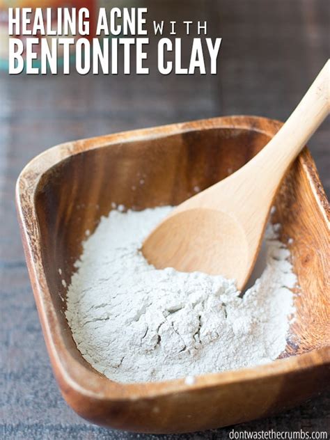 How to Heal Acne with Bentonite Clay | 3 Simple Steps