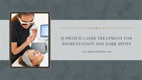 Q Switch Laser Treatment for Pigmentation and Dark Spots