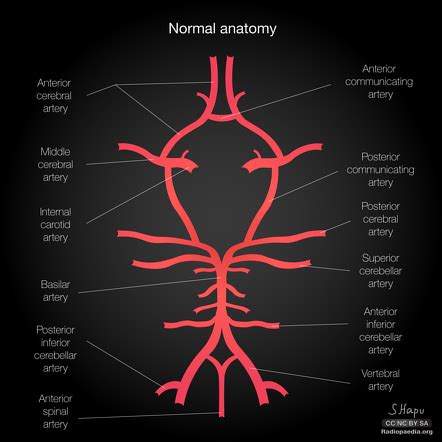 Posterior Spinal Artery