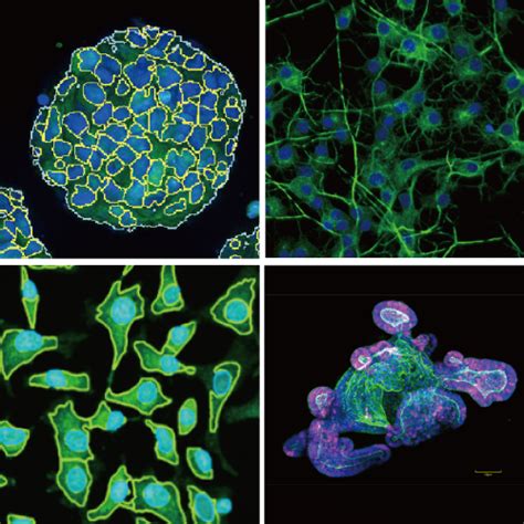 CQ1 Benchtop High-Content Analysis System | Confocal High Content Imaging