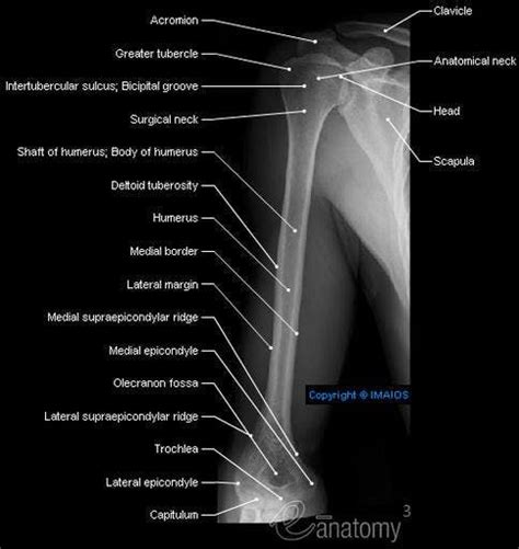 Radiography - Arm - Humerus : Shaft of humerus; Body of humerus ...