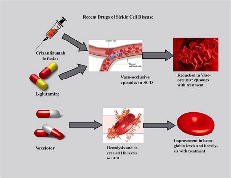 Efficacy and safety of recently approved drugs for sickle cell disease ...