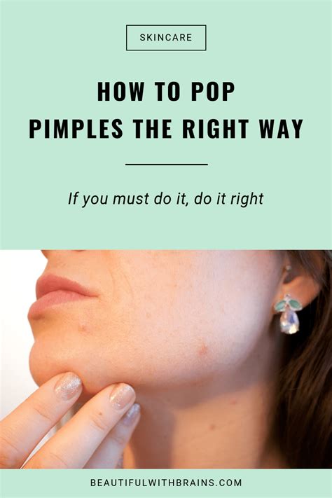 How To Pop A Pimple Like A Derm – Beautiful With Brains