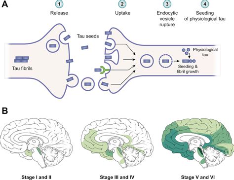 Propagation of tau pathology in Alzheimer’s disease. a Mechanisms of ...