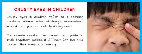 Crusty Eyes in Children: What Every Parent Needs to Know