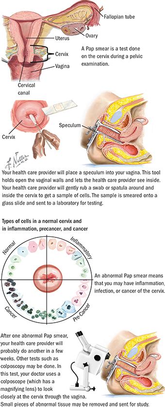 abnormal pap smear colposcopy