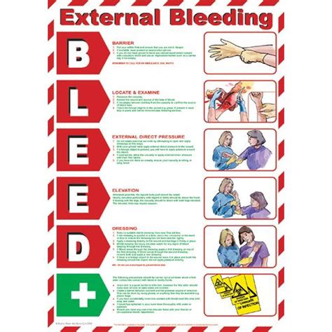 First Aid for External Bleeding | First Aid | Pinterest | First aid