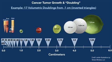 Lung Tumor Size Chart - Best Picture Of Chart Anyimage.Org