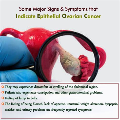 Dr Sarika Gupta: Some Major Signs & Symptoms that indicate epithelial ...