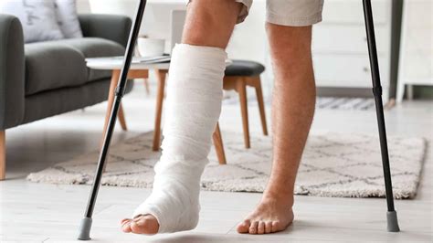 4 Signs to Know if You Have a Broken Leg - Kingwood Emergency Hospital