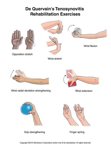 De Quervain's Tenosynovitis Exercises: Illustration ... Physical ...