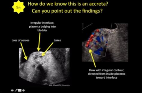 an x - ray shows the different areas in which you can see what they are ...