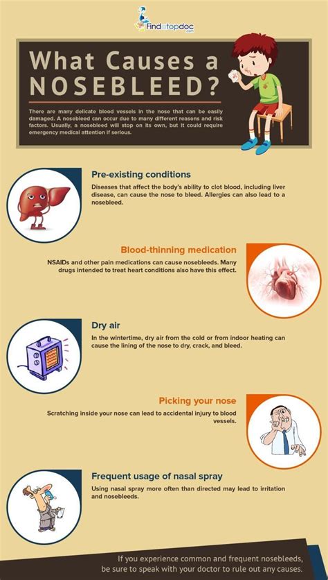 Nose Bleed: Causes, Diagnosis, and Treatment | FindATopDoc