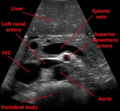 Medical ultrasound, Ultrasound technician, Ultrasound sonography