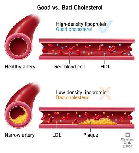 What Is Cholesterol?