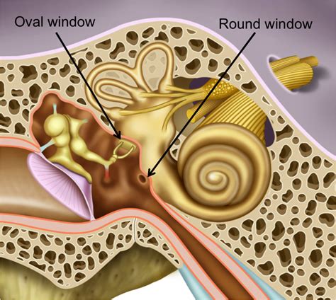 Perilymphatic fistula | Polyclinique Centre-Ville