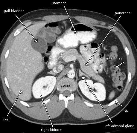 Abdominal and Pelvic CT