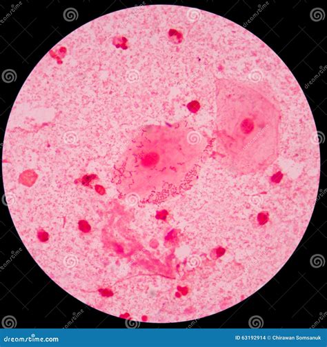 Red Leukocyte In Sputum Gram Stain Stock Photo - Image: 63192914