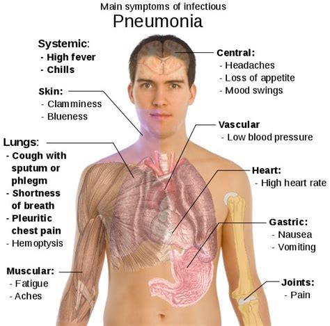 Dementia And Paranoia Treatment: Crackles In Lungs Treatment