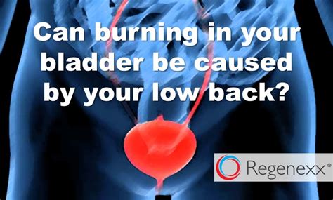 Interstitial Cystitis? Your Bladder Pain May Be Your Low Back