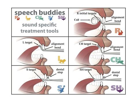 13 best What are Speech Buddies tools? images on Pinterest ...